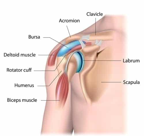 Can A Car Accident Cause Bursitis? 1 Can a Car Accident Cause Bursitis?